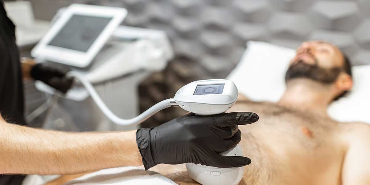 Las ventaja del HIFU en los hombres