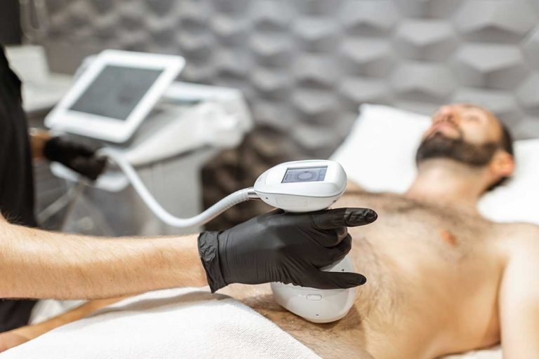 Las ventaja del HIFU en los hombres