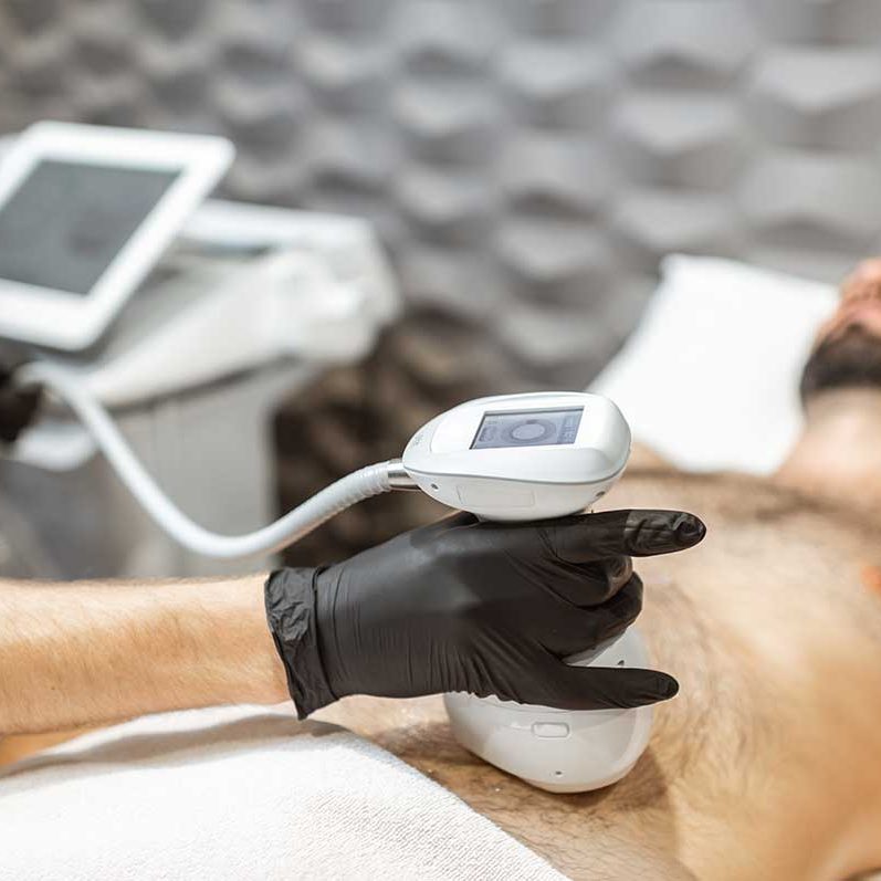 Las ventaja del HIFU en los hombres Las ventaja del HIFU en los hombres