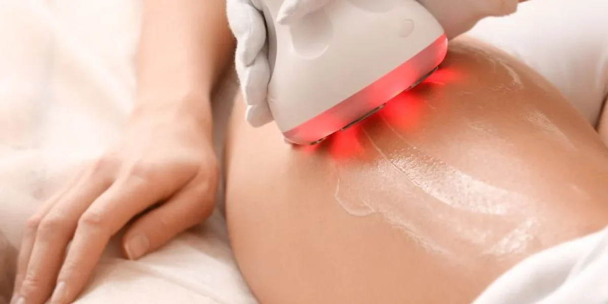 Tratamiento de Cavitación Todo lo que Necesitas Saber Tratamiento de Cavitación Todo lo que Necesitas Saber