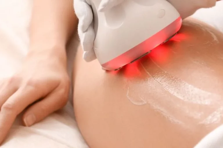 Tratamiento de Cavitación Todo lo que Necesitas Saber