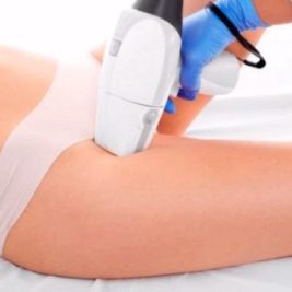 Las Máquinas de depilación láser definitiva Las Máquinas de depilación láser definitiva