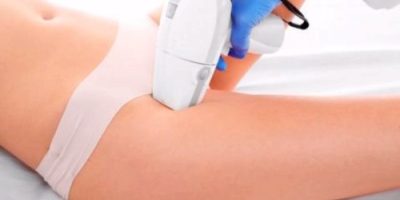 Las Máquinas de depilación láser definitiva Las Máquinas de depilación láser definitiva