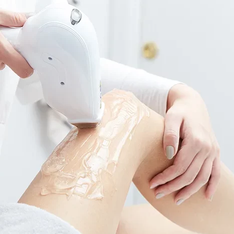 Luz pulsada intensa para DEPILACIÓN Luz pulsada intensa para DEPILACIÓN