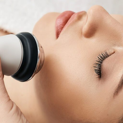 Radiofrecuencia facial efecto rebote