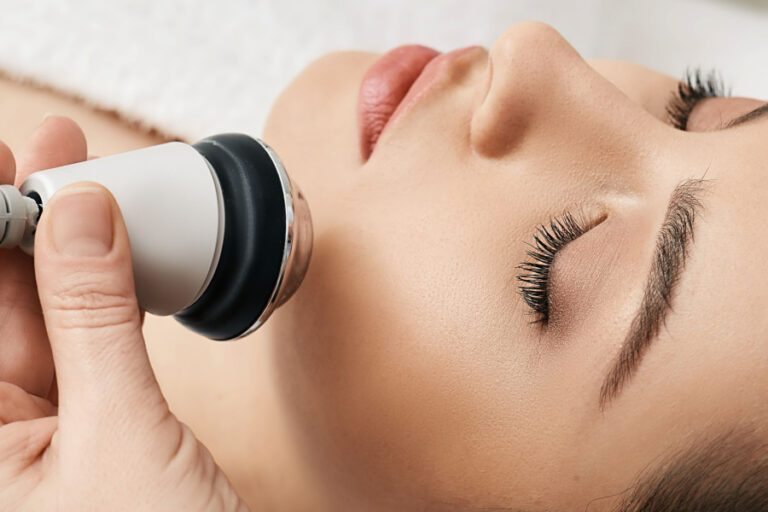 Radiofrecuencia facial efecto rebote