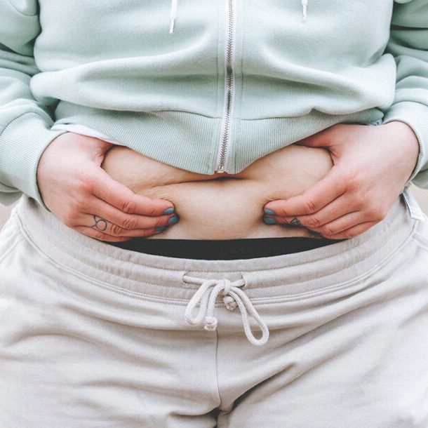 Radiofrecuencia y Cavitación Todo lo que Necesitas Saber Radiofrecuencia y Cavitación: Todo lo que Necesitas Saber